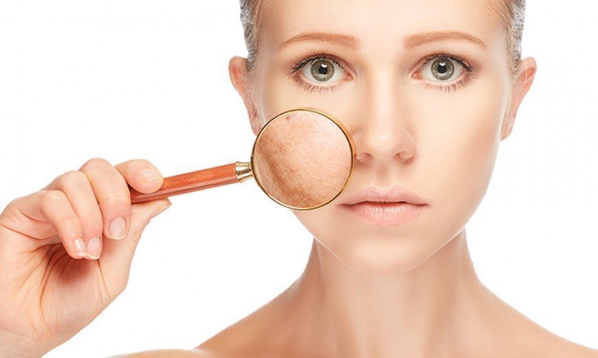 Can Red Light Therapy Make Melasma Worse