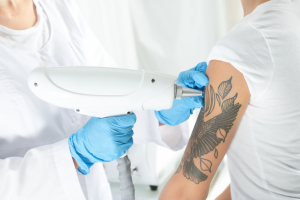 Will Red Light Therapy Fade Tattoos?