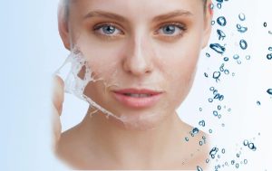 Can You Do Red Light Therapy After a Chemical Peel