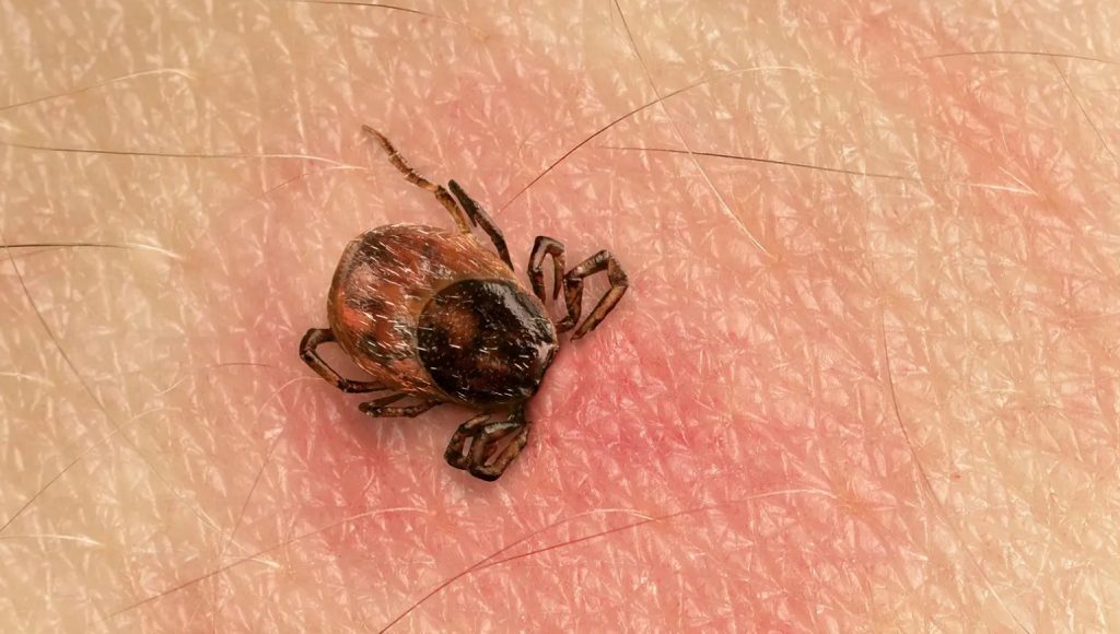 Can Red Light Therapy Reduce Inflammation Caused by Lyme Disease?
