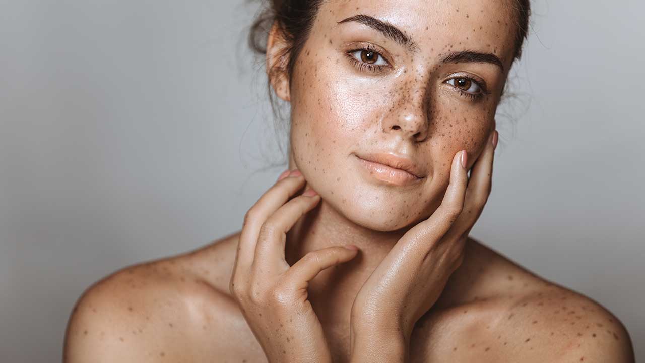 Does Red Light Therapy Increase Melasma?