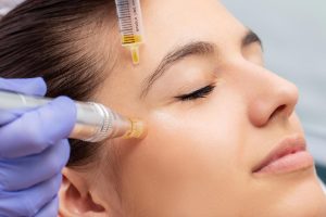 Can I Use Red Light Therapy After Microneedling