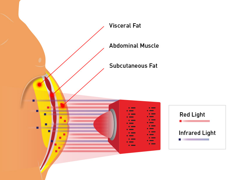 red Light Therapy Device for Weight Loss